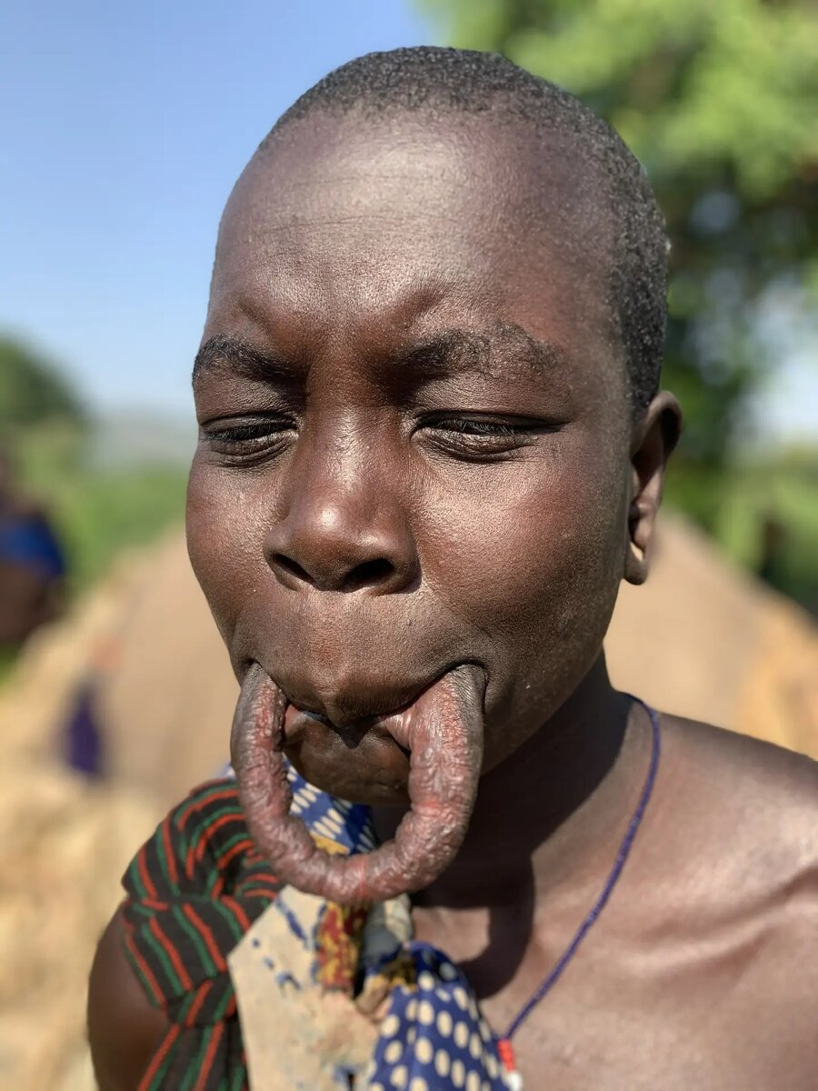 Жензина мурси с расятнутой губой