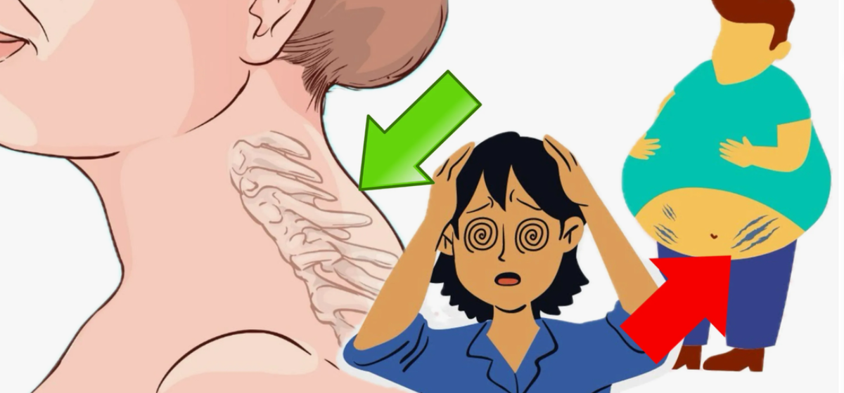 признаки повышенного кортизола