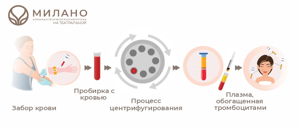 Этапы плазмотерапии 