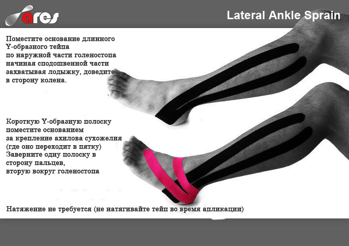 Маленькая памятка по тейпированию голеностопа.