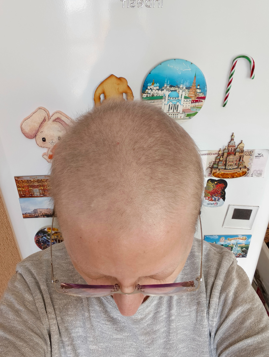 Вот такие очень редкие волосики. 