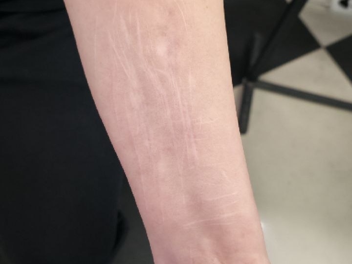 Маскировка шрамов