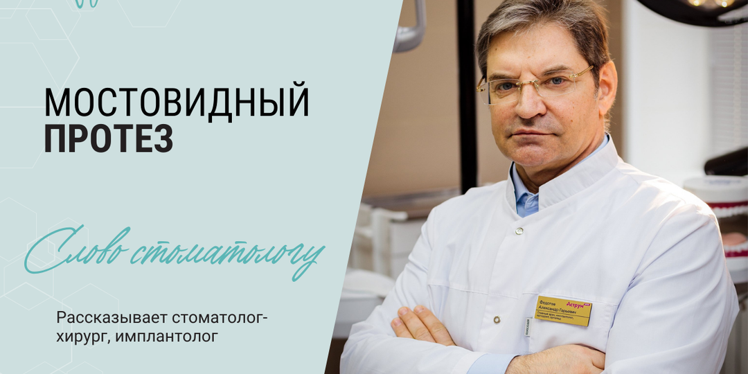 Можно ли ставить несколько мостовидных протезов