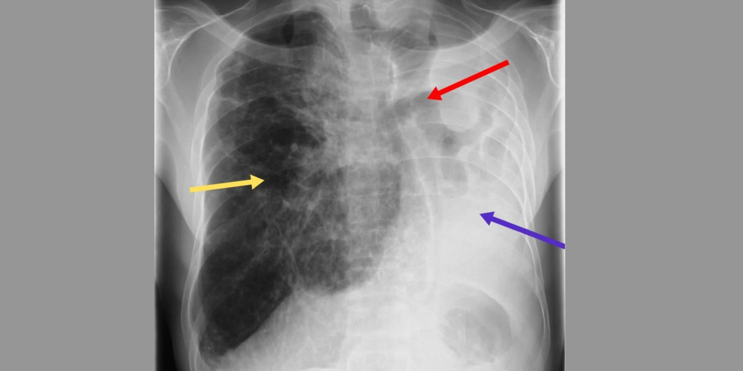 Дайджест интересных клинических случаев марта