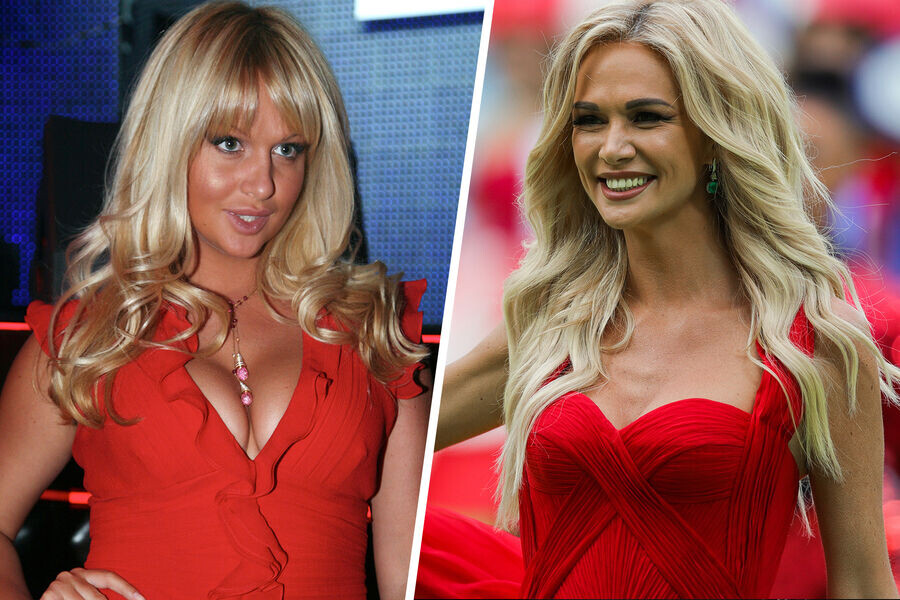 Лопырева до и после пластики