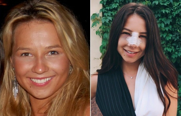 Валерия Чекалина до популярности.