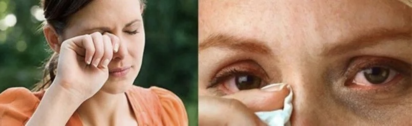 Светобоязнь