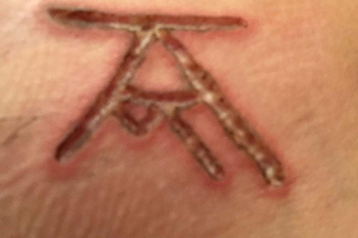 Фото с сайта: https://nypost.com/2019/05/15/this-is-how-nxivm-leader-keith-raniere-allegedly-branded-his-slaves/