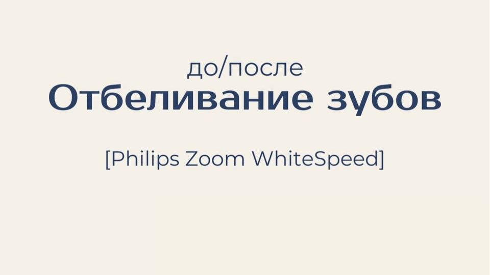 Белоснежная улыбка — это уверенность, первое впечатление и ощущение ухоженности