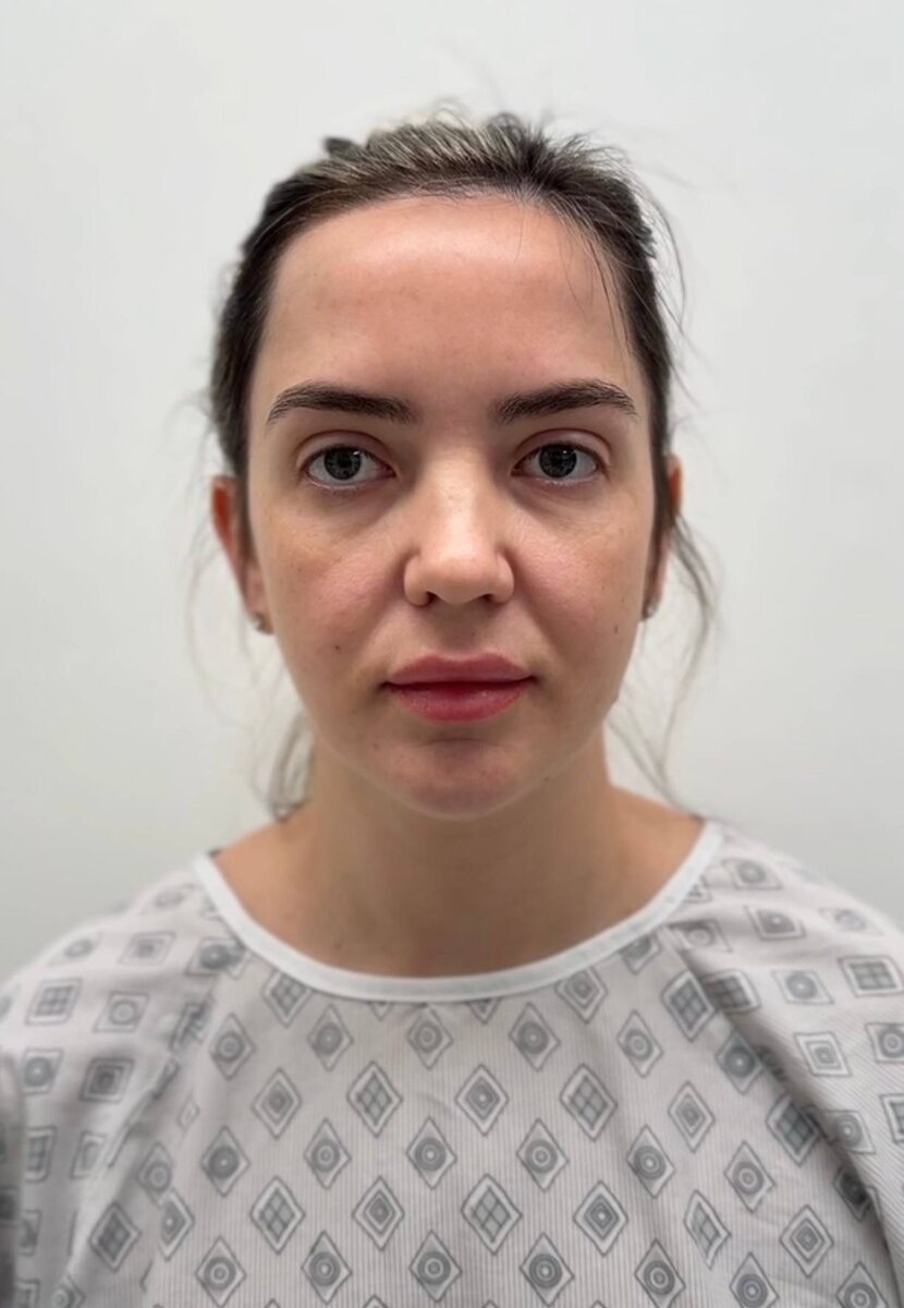 До операции