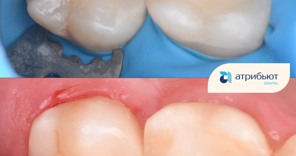 🔍 Найти причину, а не просто исправить