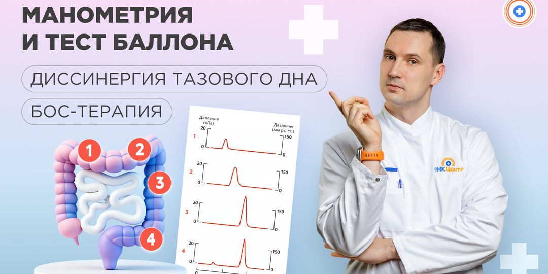 Манометрия и тест баллона: как подтверждают диссинергию тазового дна и выбирают БОС-терапию