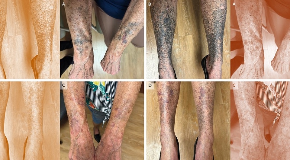   N + 1; Aarti Maharaj and Michael Omar / The New England Journal of Medicine, 2026