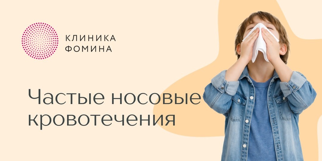 Частые носовые кровотечения у ребёнка — это «просто сосуды» или повод для обследования?