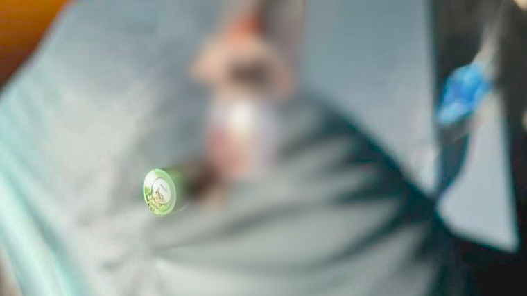    Врачи Мытищинской больницы извлекли стоматологический инструмент из бронха пациента. Фото: mz.mosreg.ru