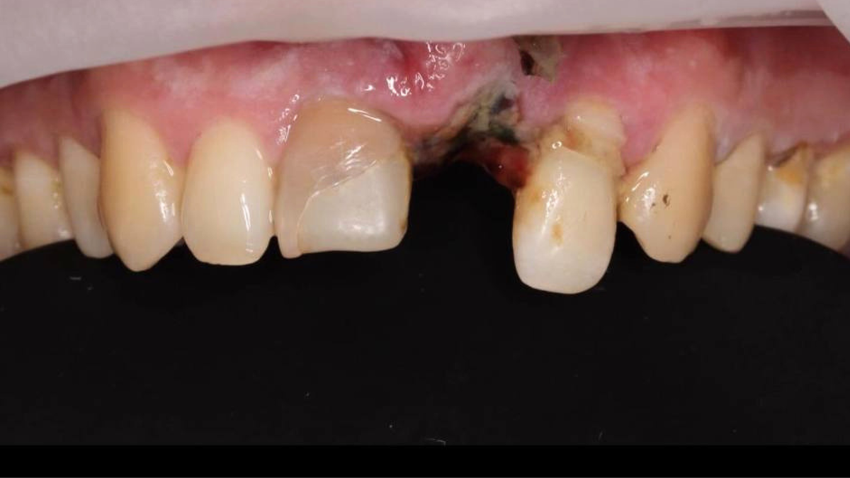 Фото нашего пациента на момент обращения в клинику. 