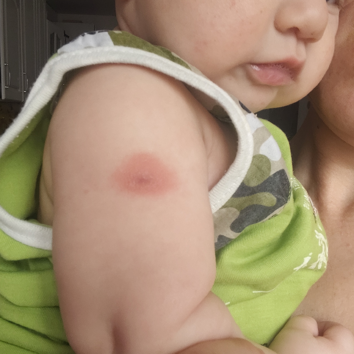 Левое плечо, фото зеркалит. 