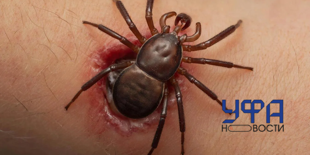 Куда жителям Башкирии нести клещей на исследование