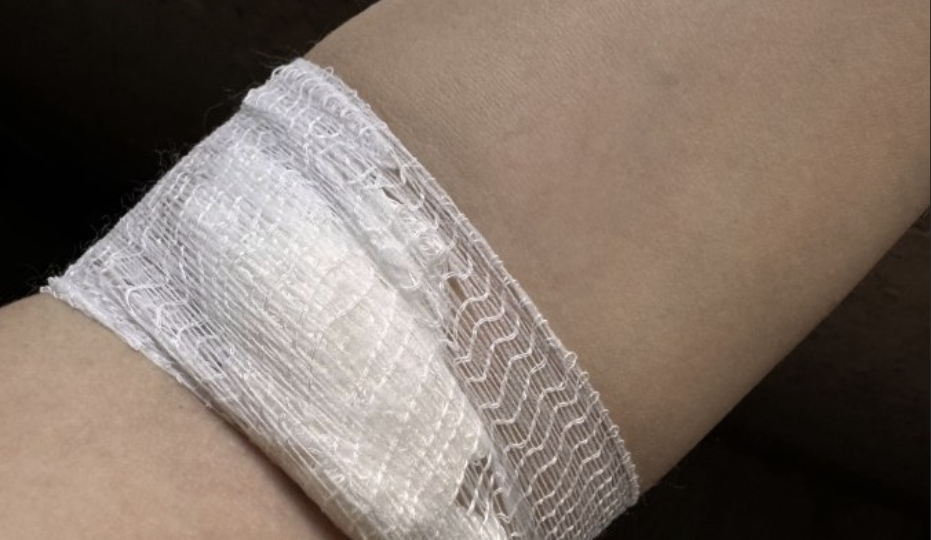 Рекордное снижение холестерина за месяц: разбор врачей