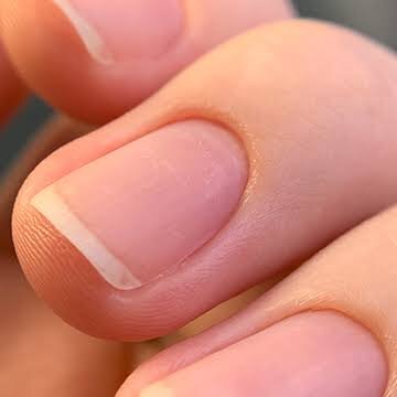 Зеркало здоровья: какие болезни можно определить по ногтям