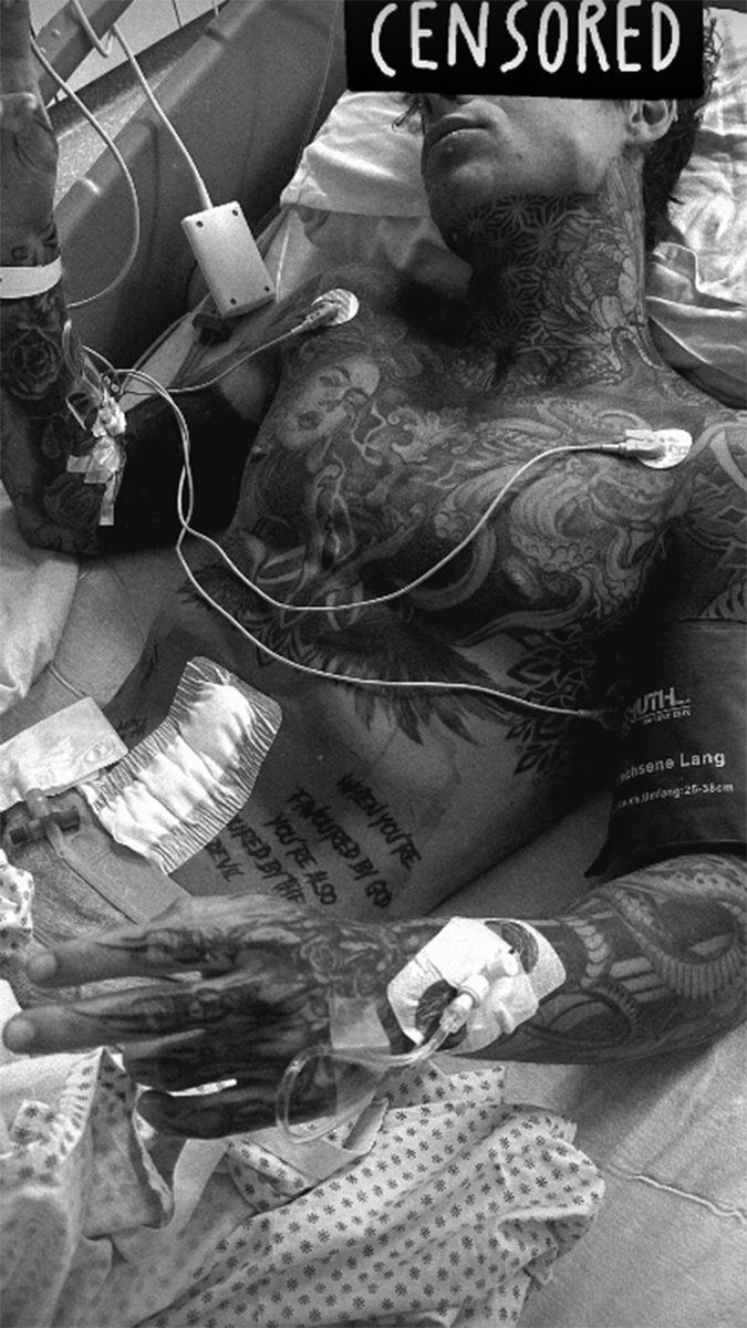    "Филяй-филяй" Самуэль Домен в больнице. Фото: соцсети