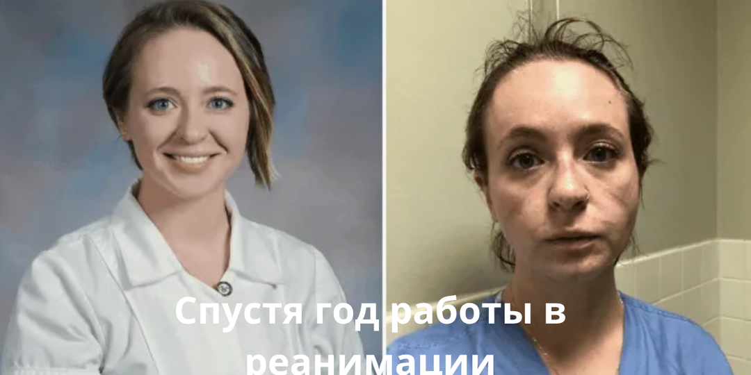 Исповедь медсестры реанимации, которая видит смерть каждый день