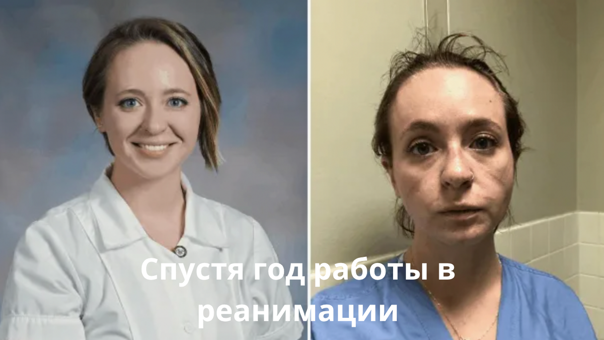 Кэтрин Нивей, 28 лет, медсестра ICU (отделение интенсивной терапии)