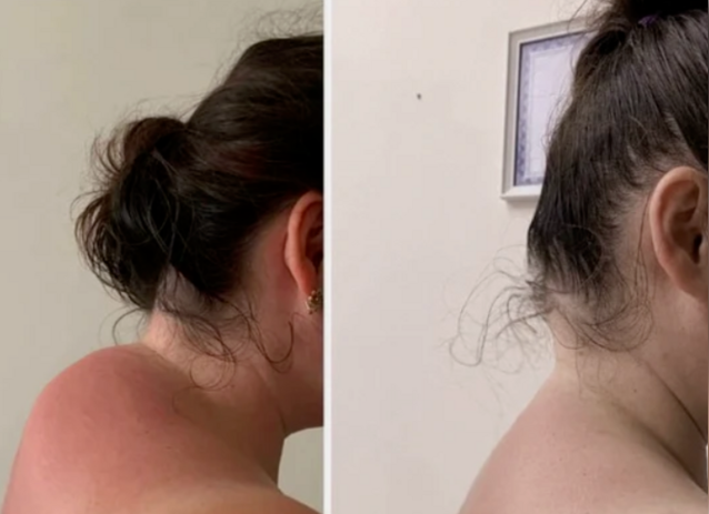     Көмрөнән нисек ҡотолорға?