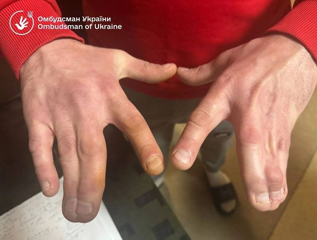     / Источник: Уполномоченный по правам человека на Украине