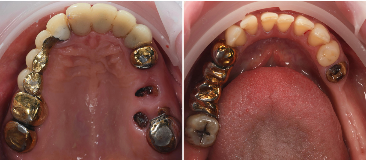 Состояние до лечения