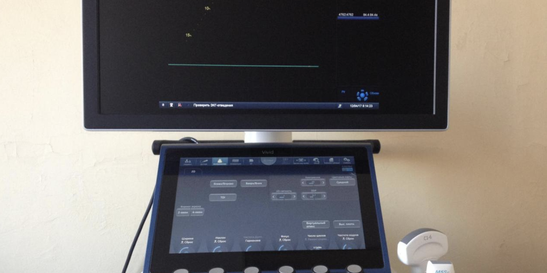 Скрытая фибрилляция предсердий: ответ врачей после инсульта