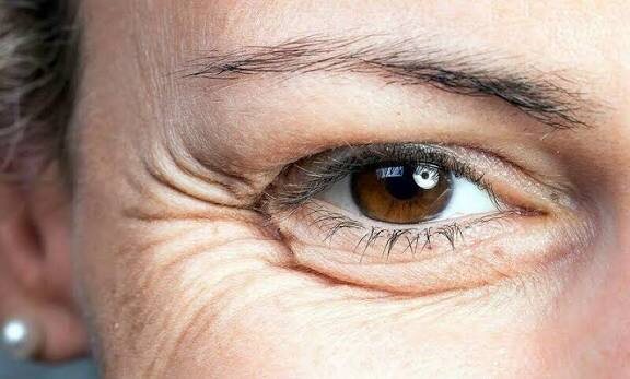 Морщины: неизбежное зло или руководство к действию?