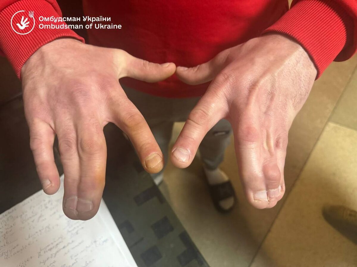    Лубинец шокировал результатами проверки ТЦК в Ужгороде — пытки, незаконное удержание и жуткая антисанитария