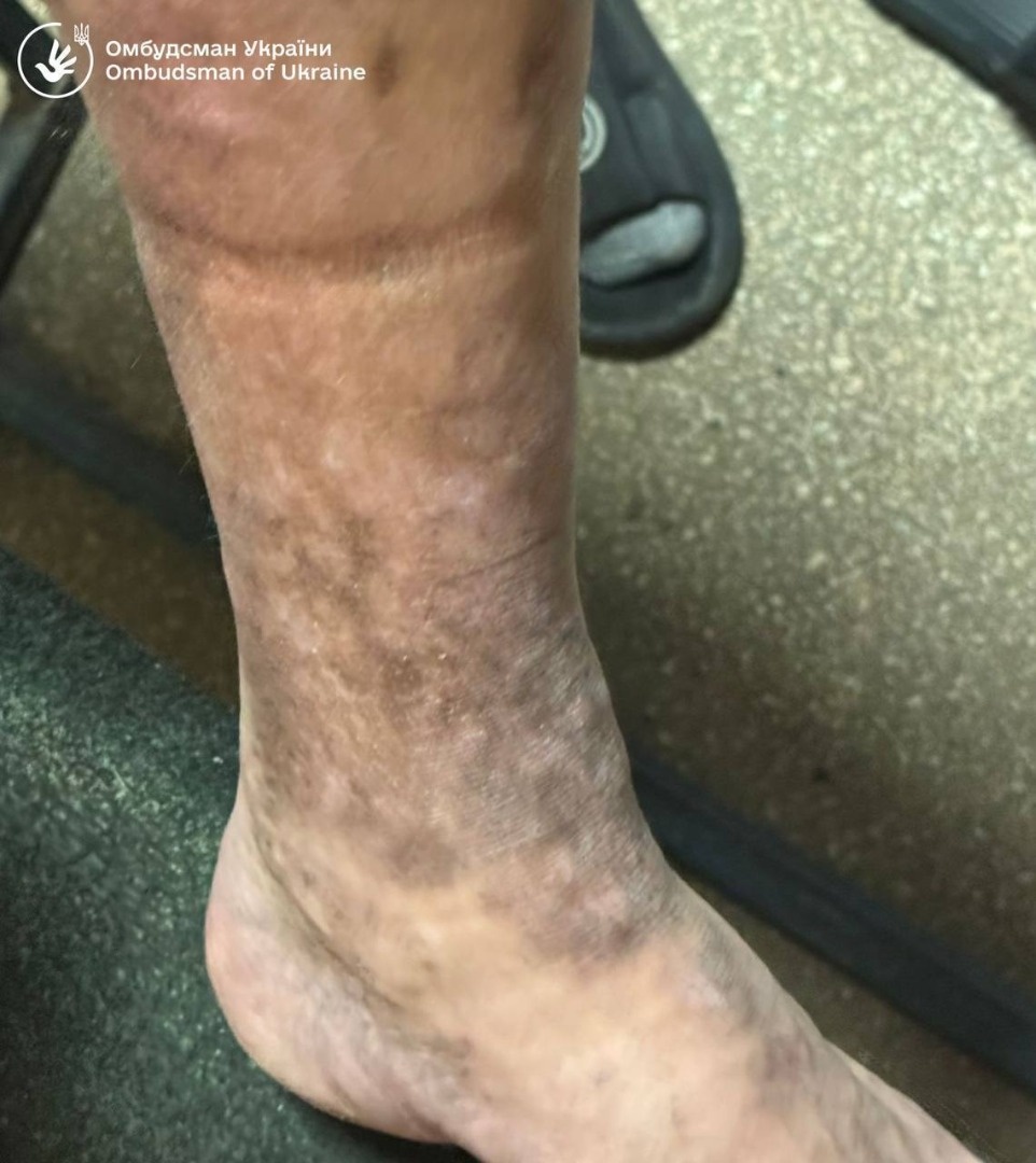    Лубинец шокировал результатами проверки ТЦК в Ужгороде — пытки, незаконное удержание и жуткая антисанитария