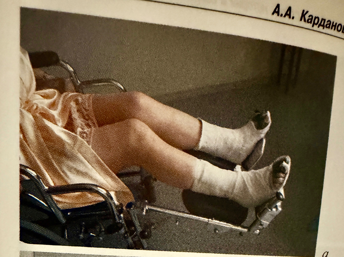 Эта москвичка съездила на операции в Нижний Новгород, по возвращении в Москву нашла меня, и сильно удивилась, увидев моих пациенток вот в таком виде (см. фото ниже)