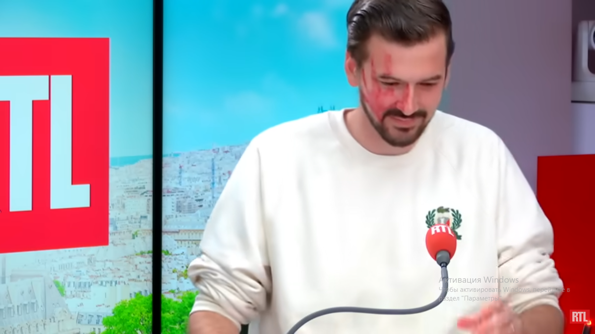 Марк-Антуан Лё Бре и со "следом ладони" на лице.