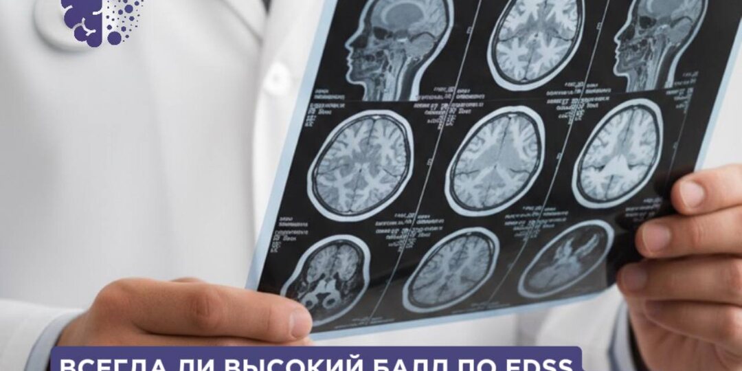 Всегда ли высокий балл по EDSS – это вторично-прогрессирующий РС? Часть 2