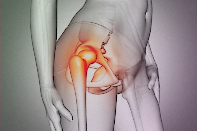 Упражнения для облегчения боли в тазобедренном суставе: Полное руководство