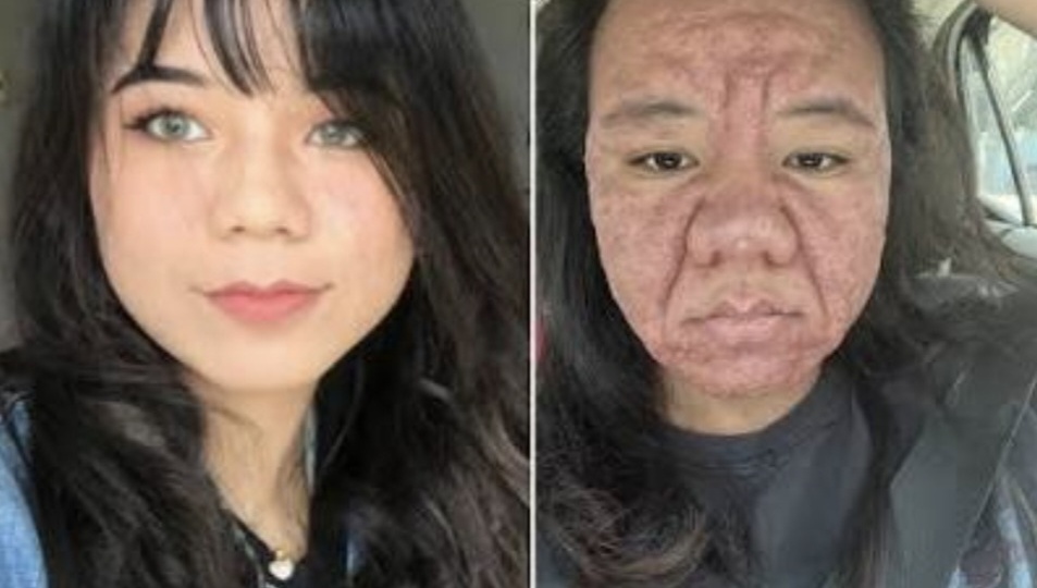 «Я не узнала себя в зеркале»: беременность превратила китаянку в другого человека, но финал истории удивил всех