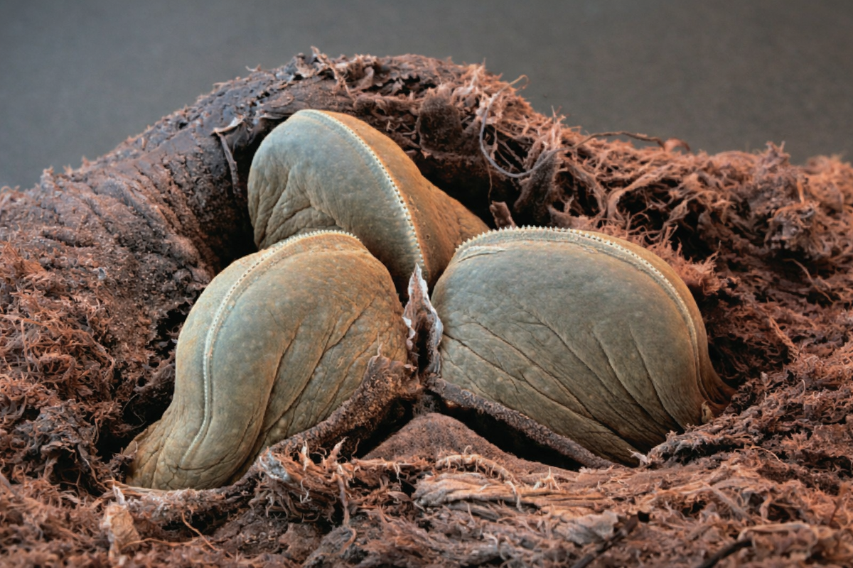 Челюсти медицинской пиявки под микроскопом.