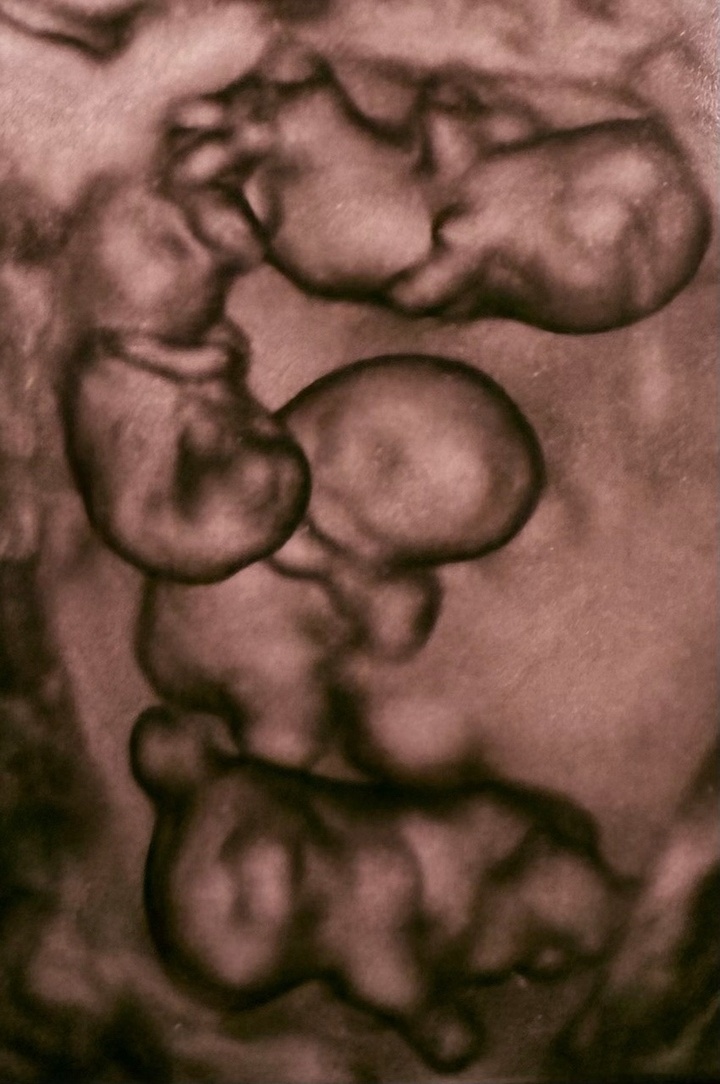     Фото: со страницы ВКонтакте заместителя главврача родильного дома №10, профессора Евгения Михайлина.