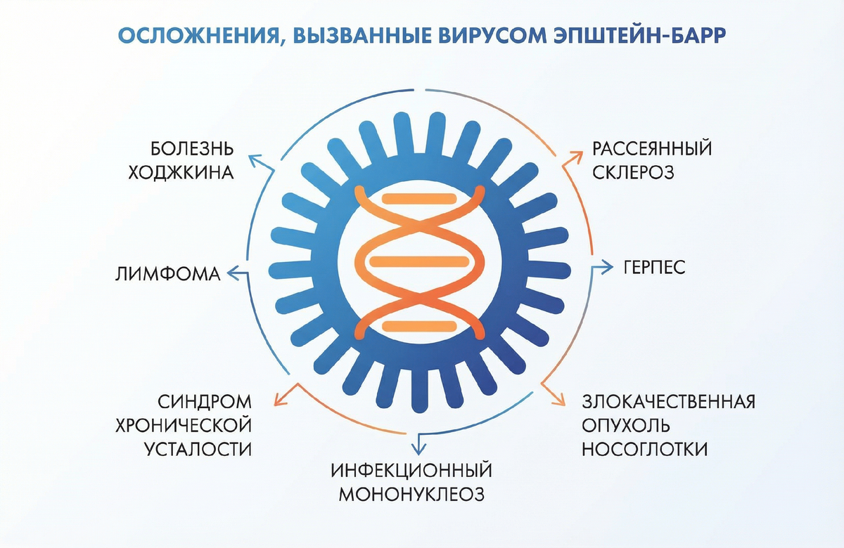 Диаграмма основных возможных осложнений, связанные с вирусом Эпштейна-Барра