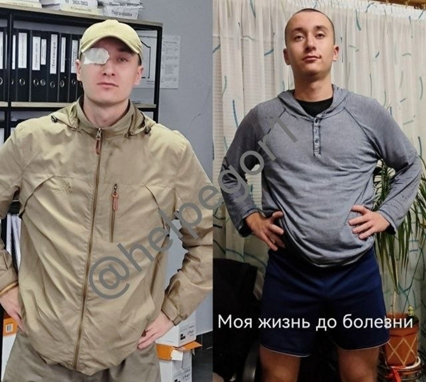После первой операции в Турции, Егор воспрянул надеждой