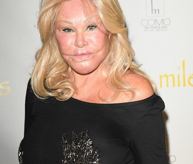 Они просто себя "перекроили" и их перестали узнавать: истории о неудачных пластических операция