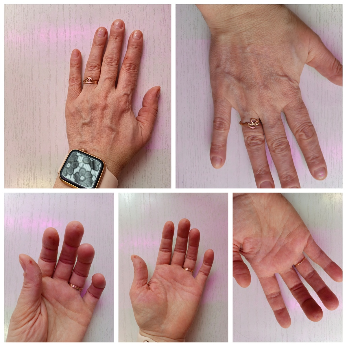 Так выглядят мои руки 