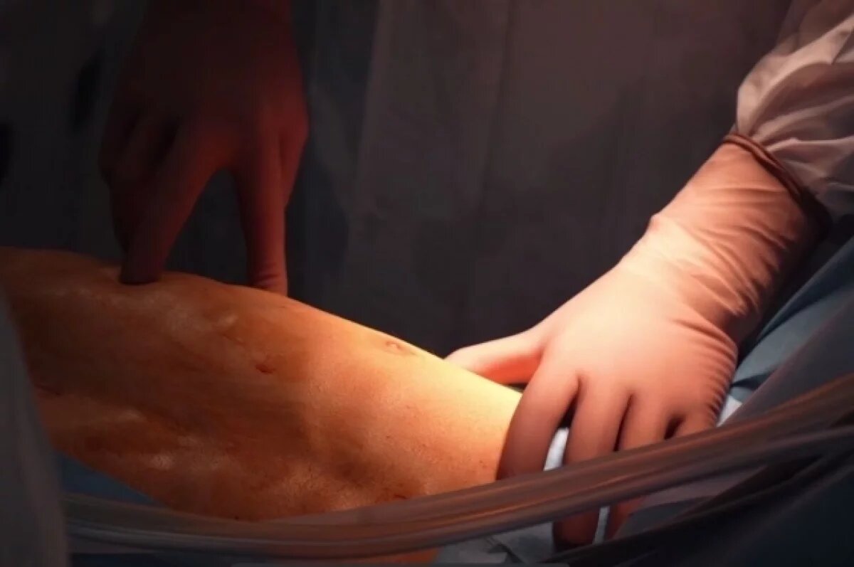    Операция была сложной