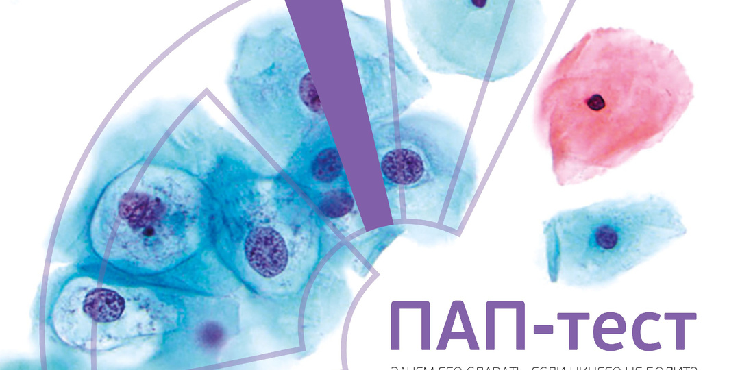 ПАП-тест. Зачем его сдавать, если ничего не болит?