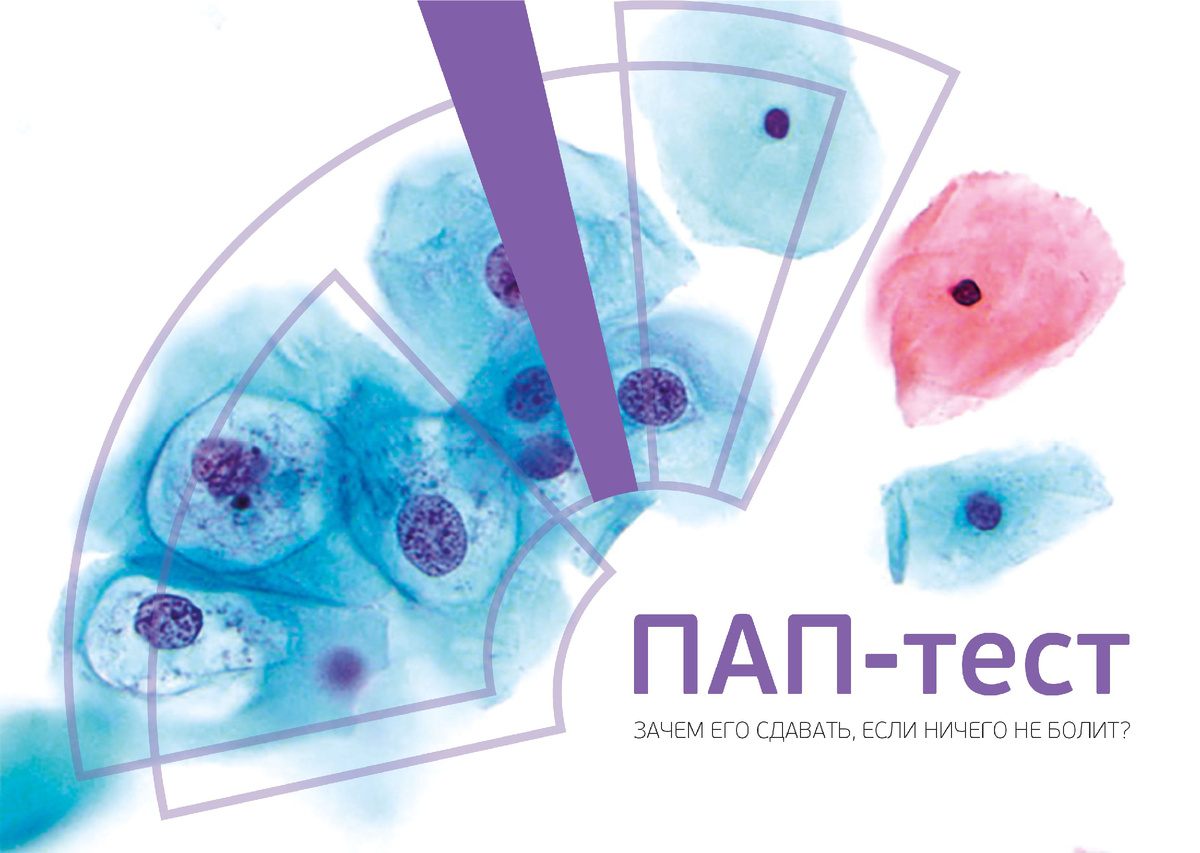 ПАП-тест: зачем его сдавать, если ничего не болит?