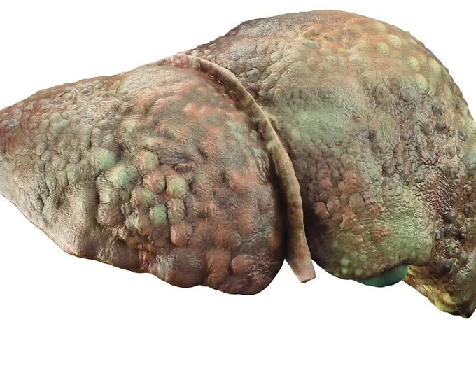 Как быстро восстановить печень если долго пил до этого?