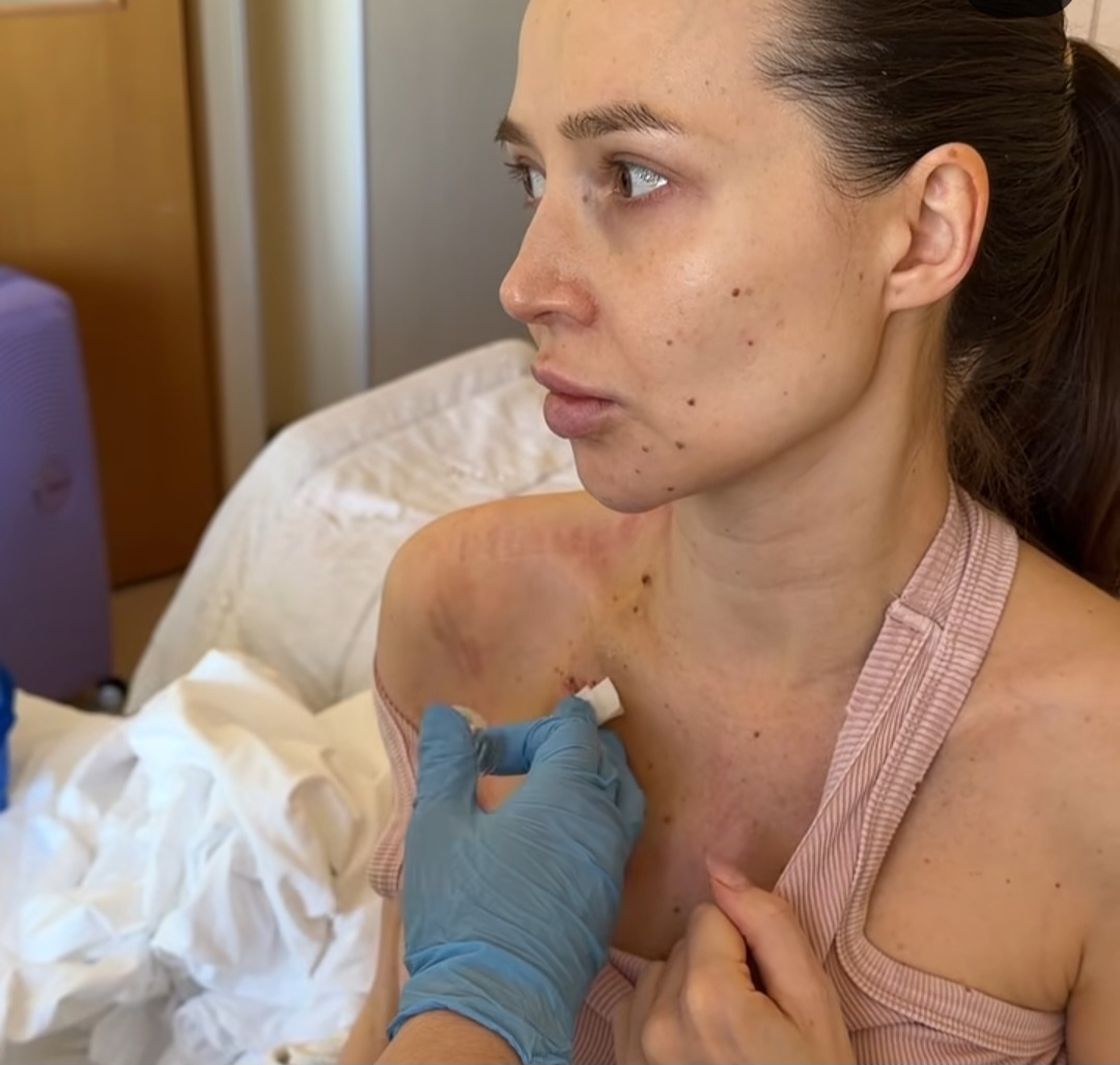    Блогер Лерчек проходит лечение от онкологии. Источник фото - соцсети